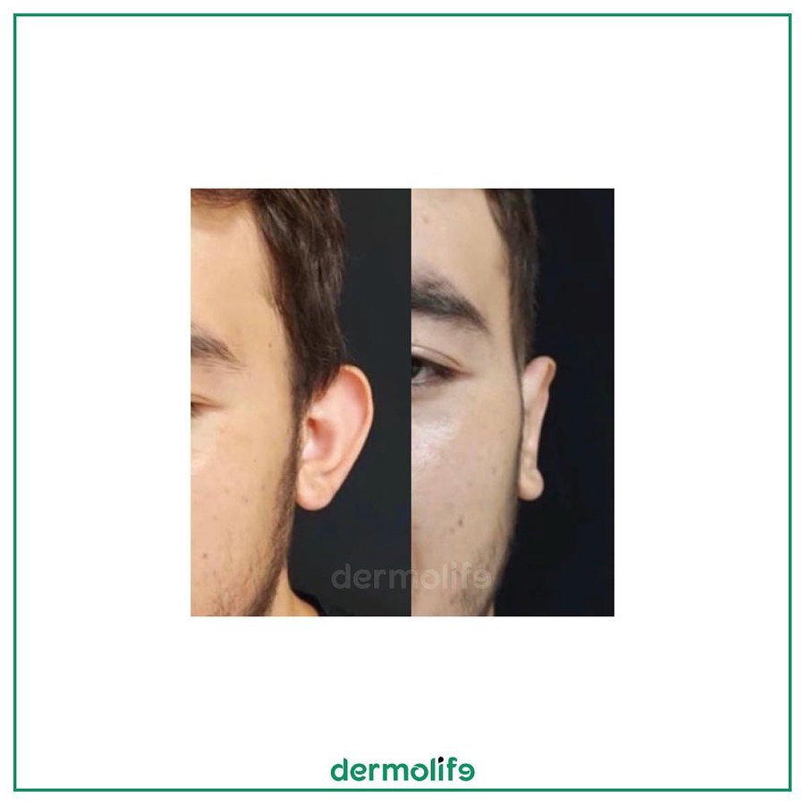 Dermolife - Dermolife