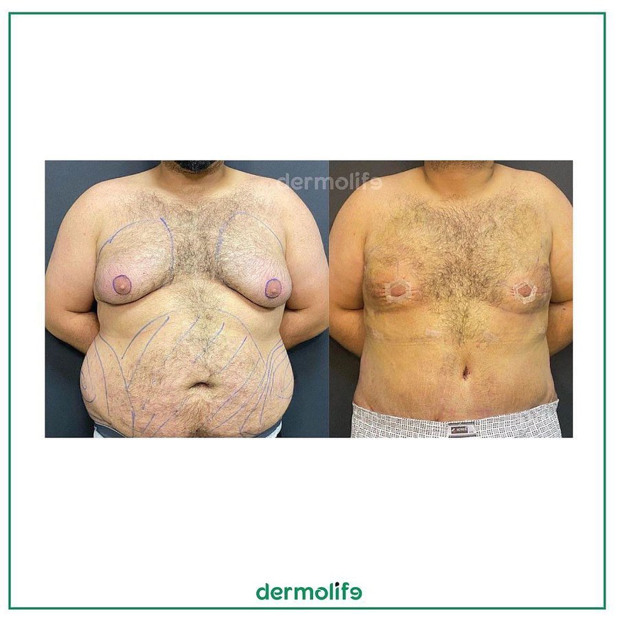 Dermolife - Dermolife