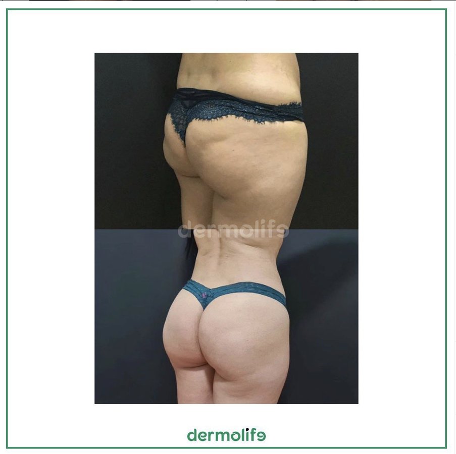 Dermolife - Dermolife