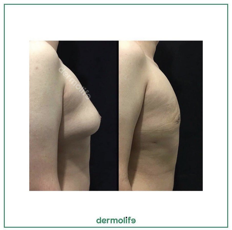 Dermolife - Dermolife