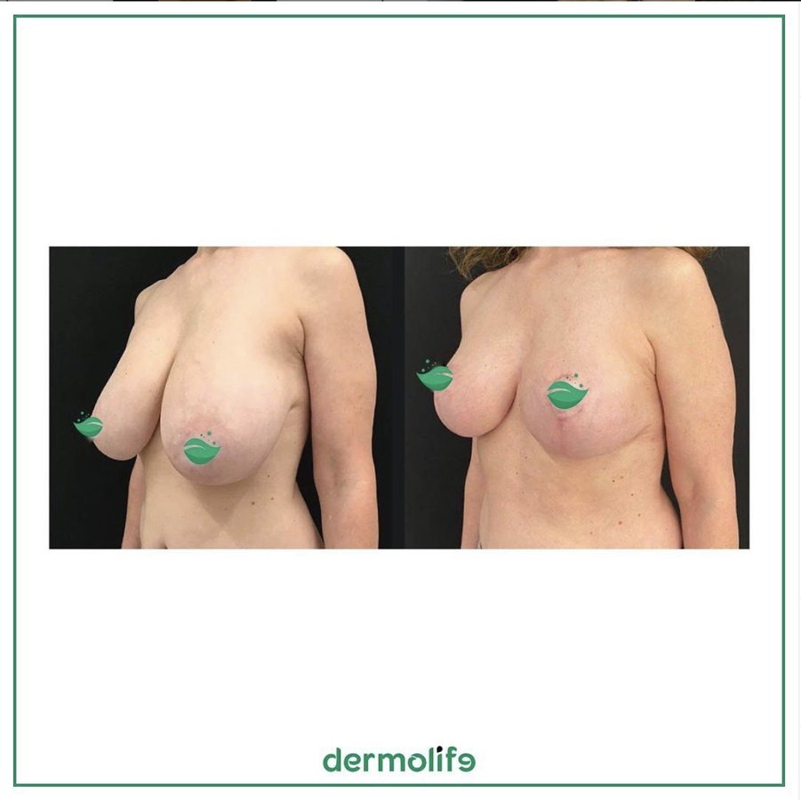 Dermolife - Dermolife