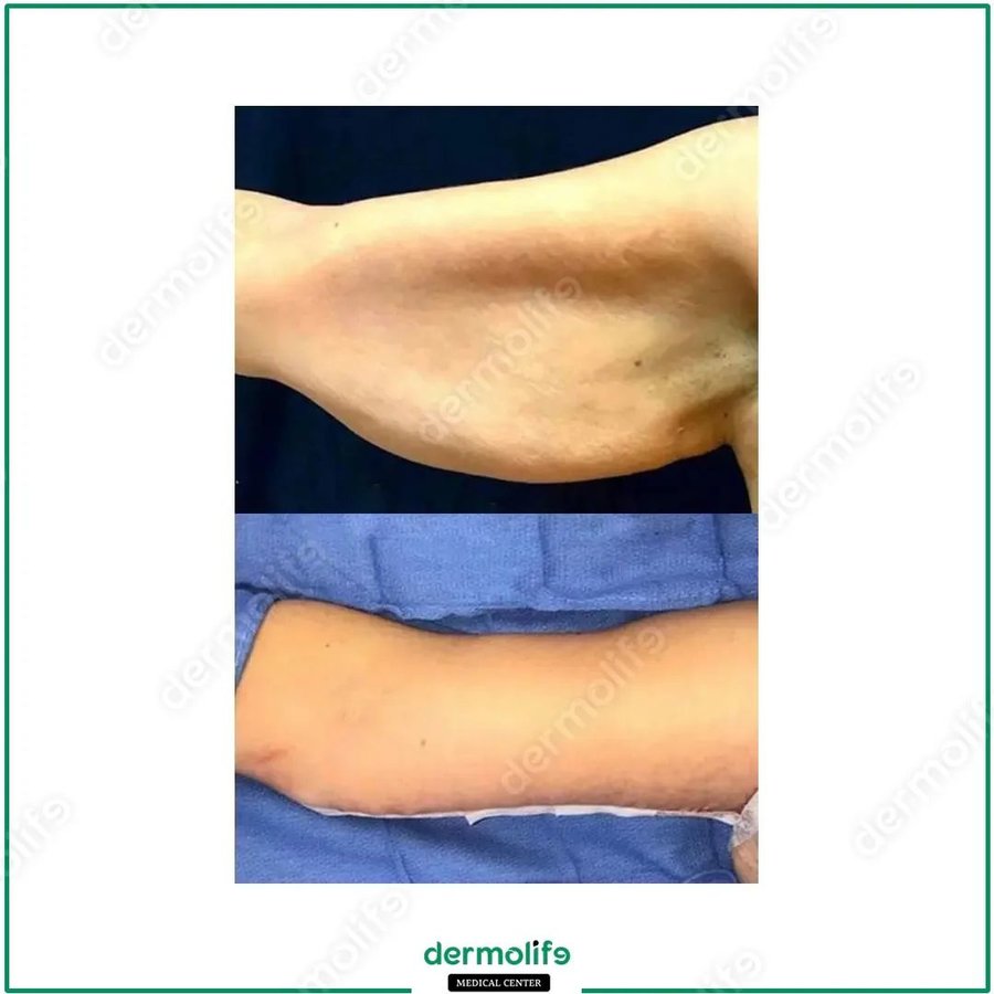 Dermolife - Dermolife