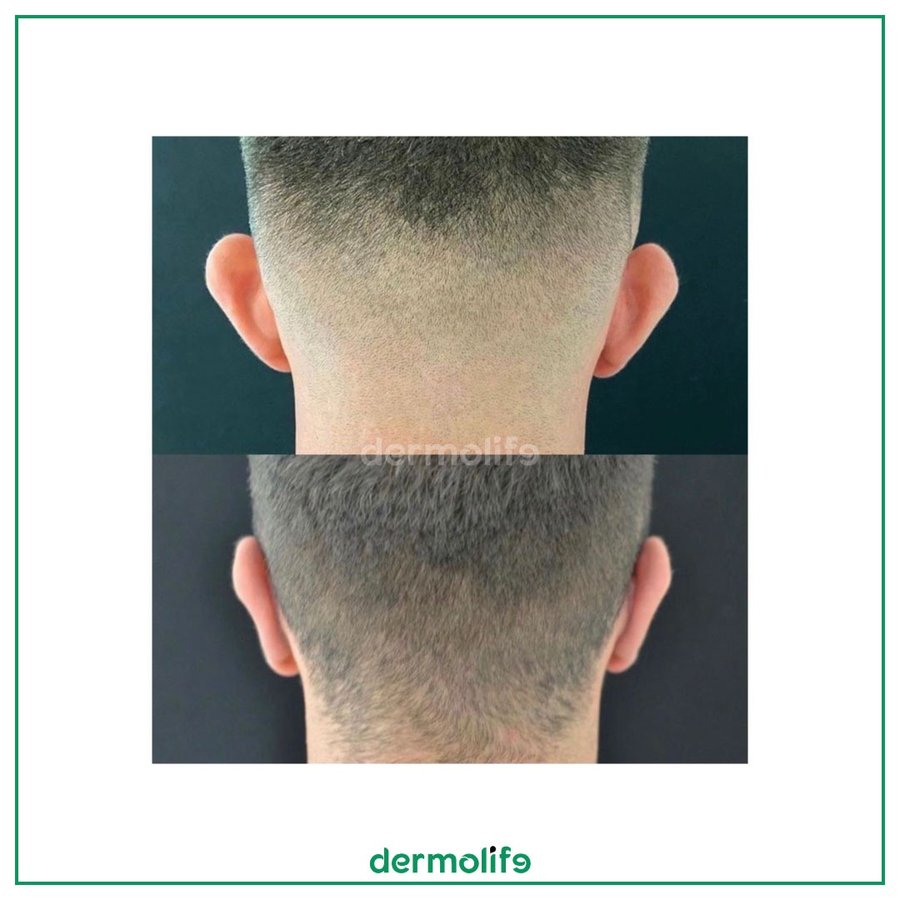 Dermolife - Dermolife