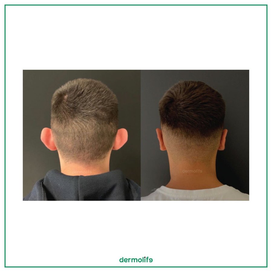 Dermolife - Dermolife