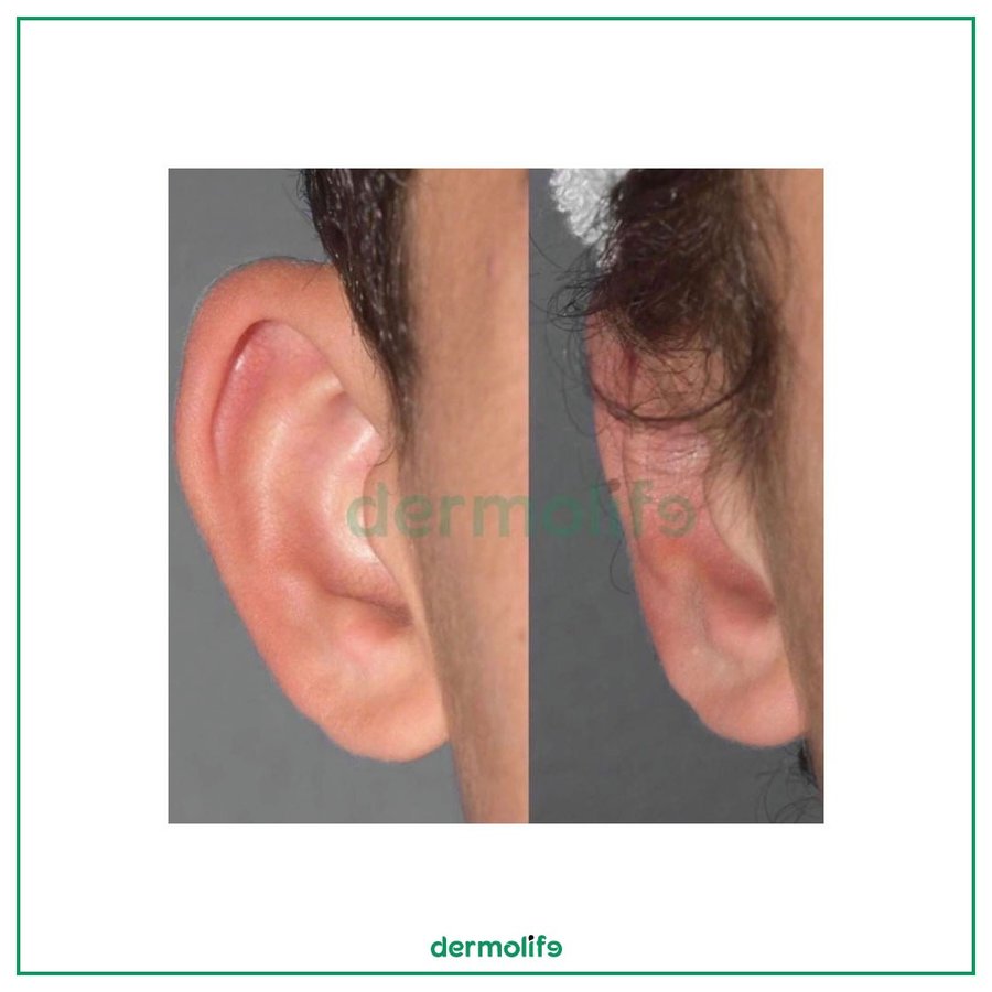 Dermolife - Dermolife