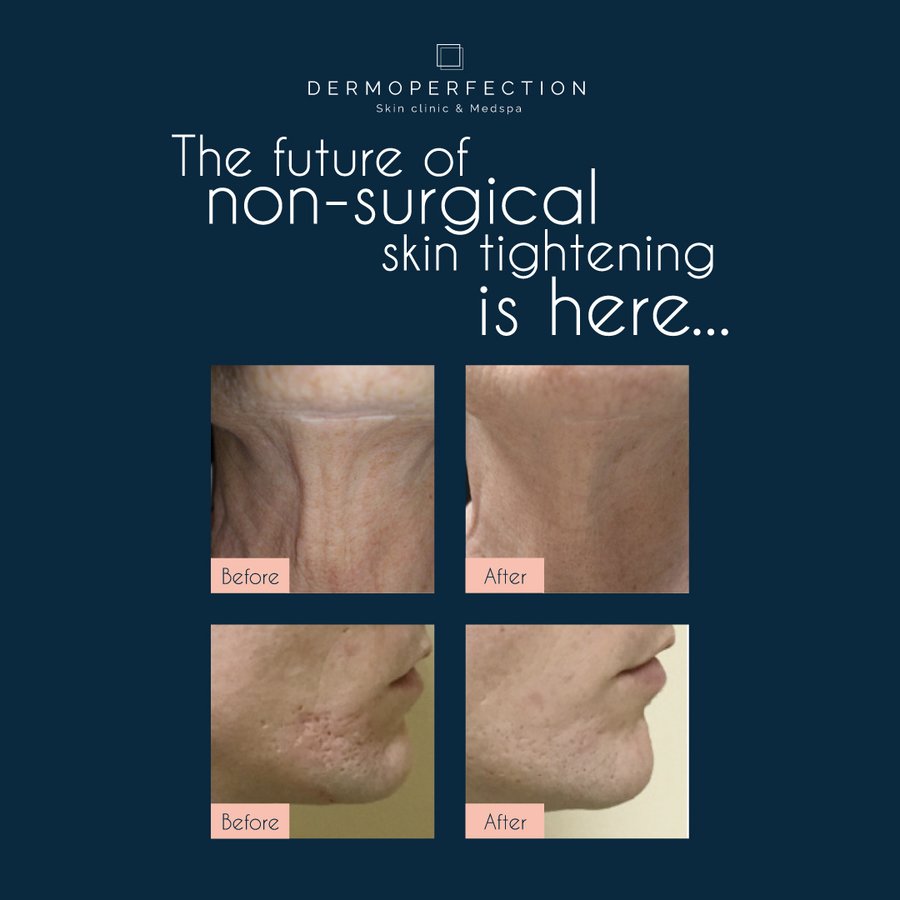 Dermoperfection Medical Skin and Cosmetic Clinic - Dermoperfection Medical Skin and Cosmetic Clinic