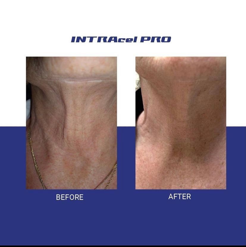 Dermoperfection Medical Skin and Cosmetic Clinic - Dermoperfection Medical Skin and Cosmetic Clinic