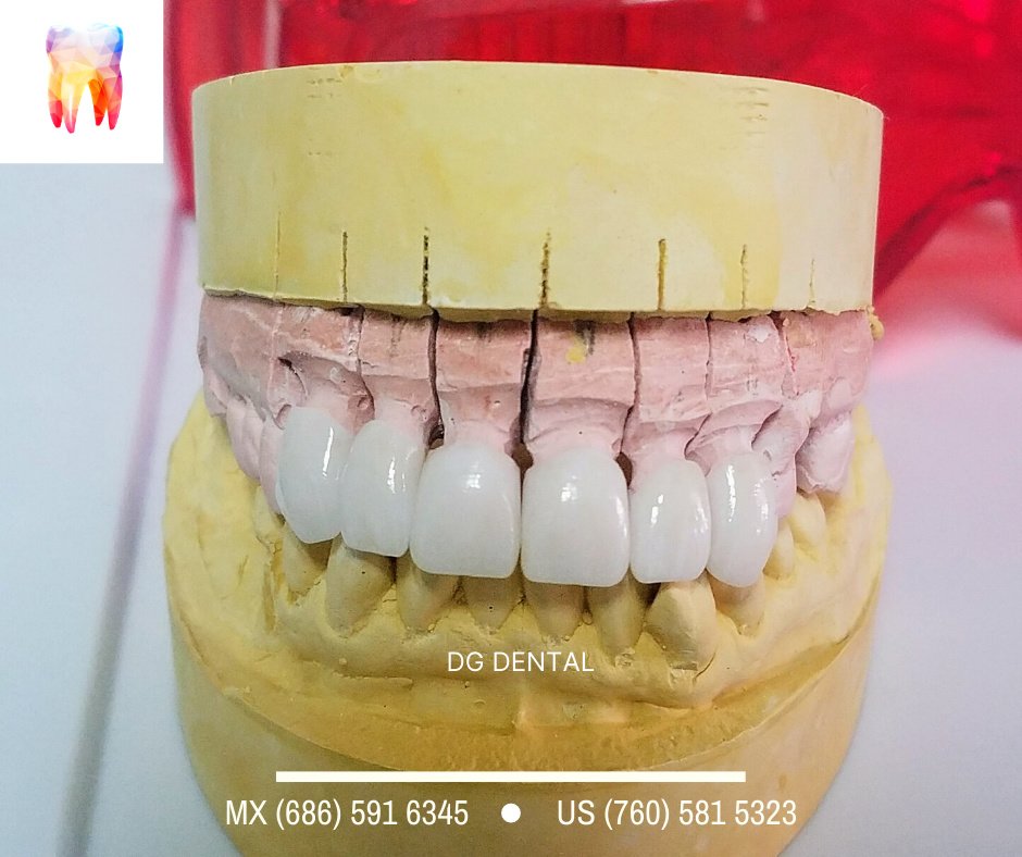 DG Dental Mexicali - DG Dental Mexicali