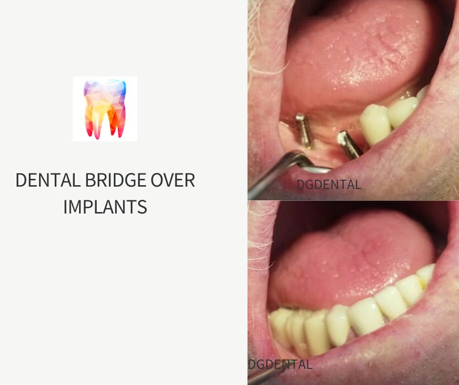 DG Dental Mexicali - DG Dental Mexicali