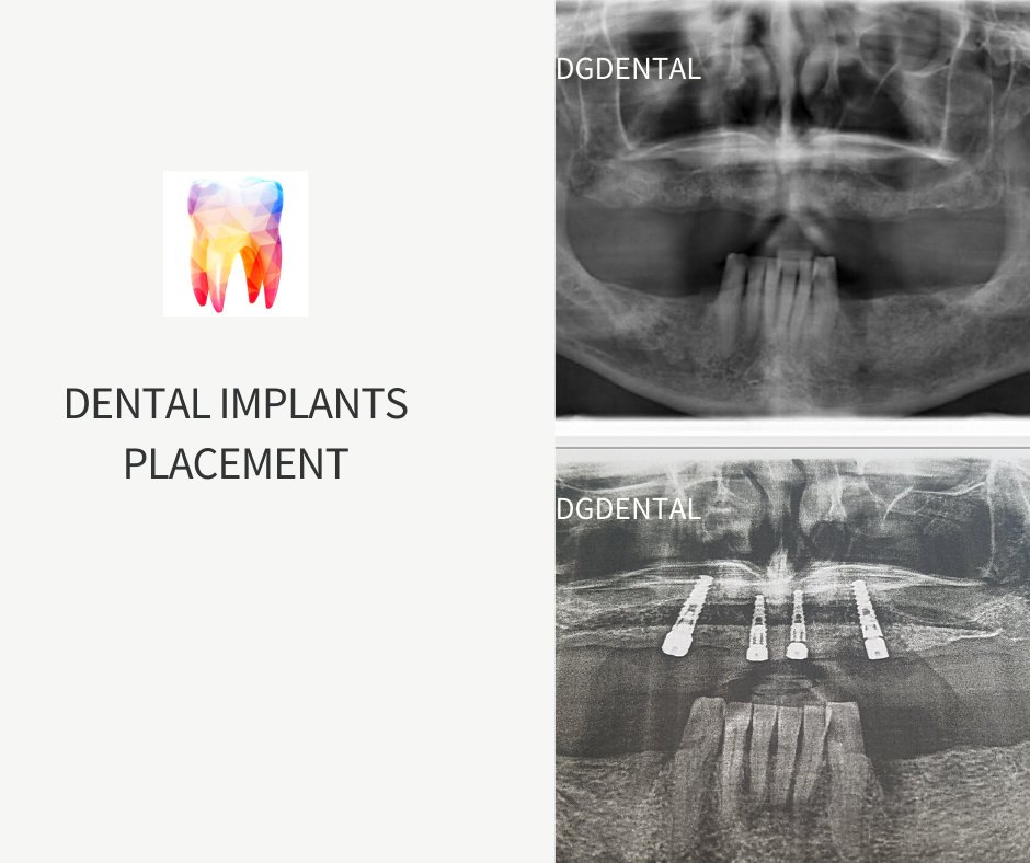 DG Dental Mexicali - DG Dental Mexicali