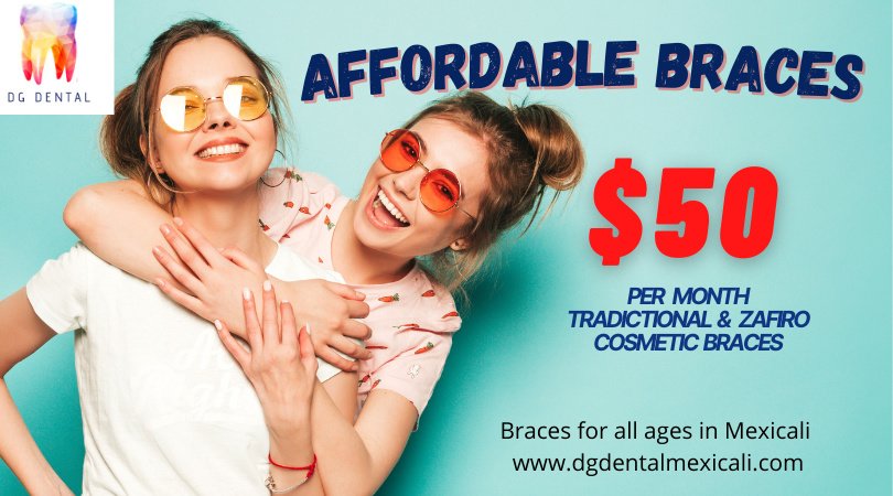 DG Dental Mexicali - DG Dental Mexicali