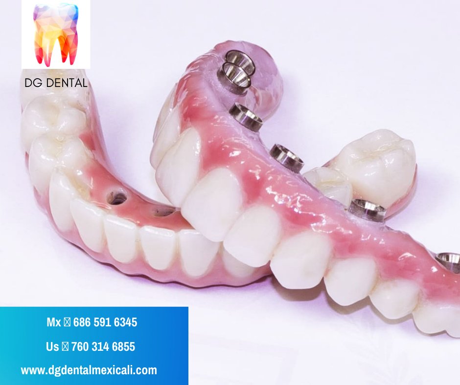 DG Dental Mexicali - DG Dental Mexicali