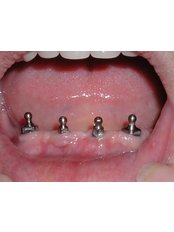 Dhanwanth Dental Care - Dhanwanth Dental Care