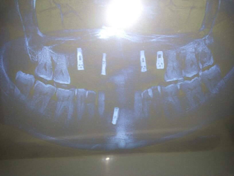 Dhanwanth Dental Care - Dhanwanth Dental Care