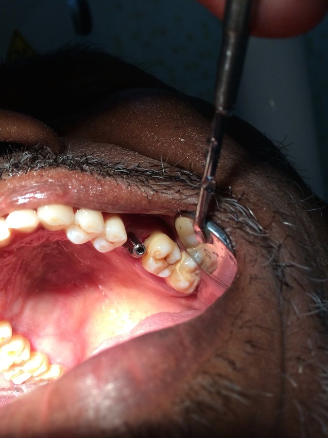 Dhanwanth Dental Care - Dhanwanth Dental Care