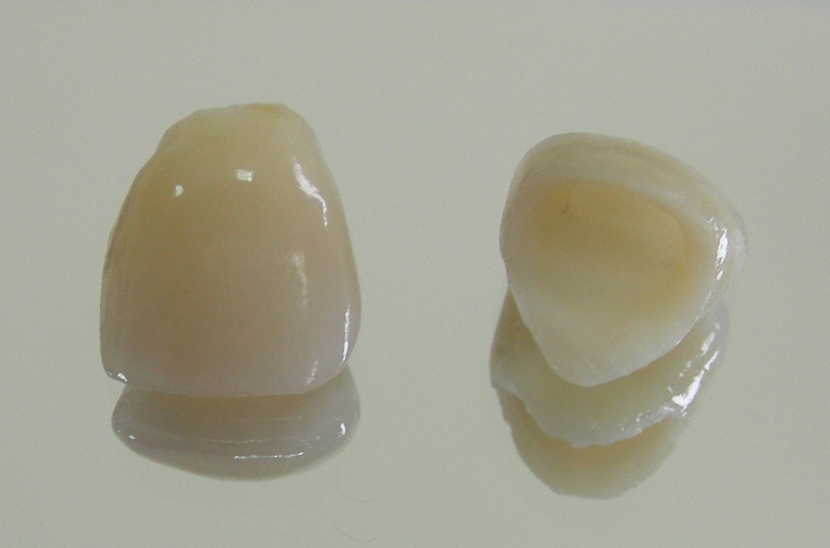 Dhanwanth Dental Care - Dhanwanth Dental Care