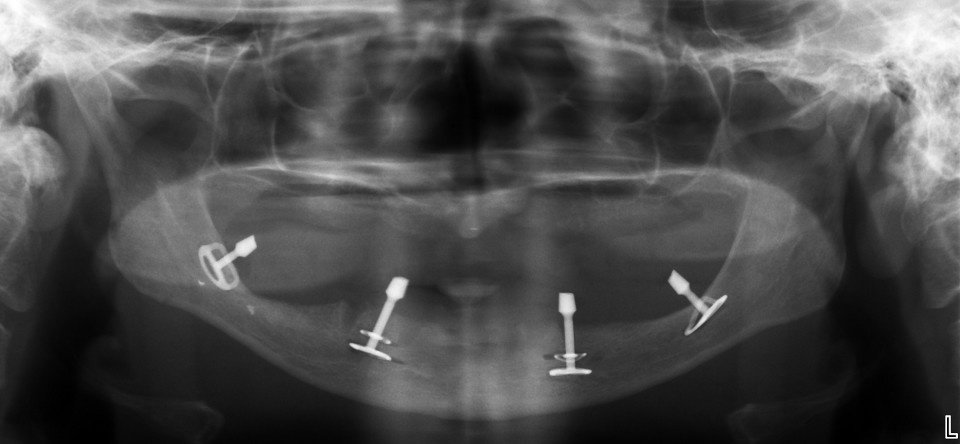 Dhanwanth Dental Care - Dhanwanth Dental Care