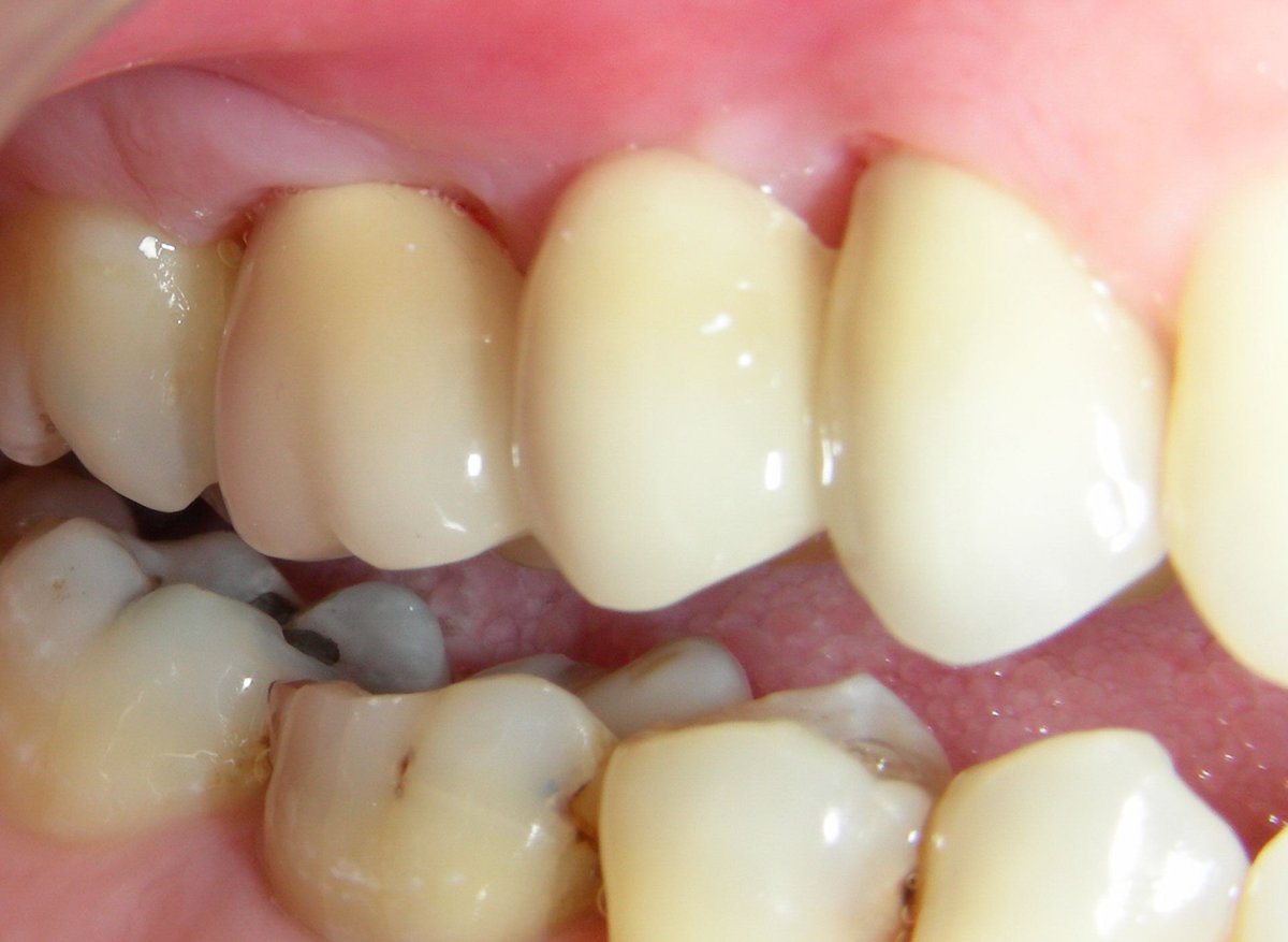 Dhanwanth Dental Care - Dhanwanth Dental Care