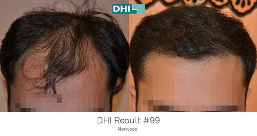 DHI - Chennai - DHI - Chennai