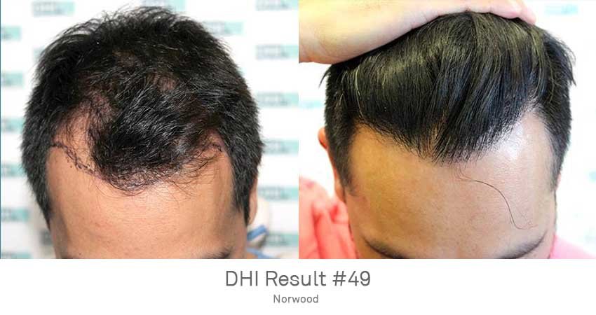 DHI - Chennai - DHI - Chennai