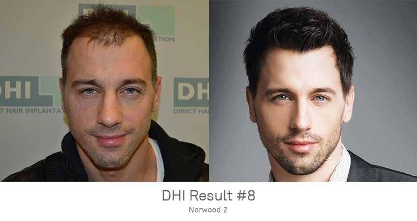 DHI - Chennai - DHI - Chennai