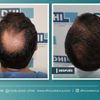 DHI Costa Rica - DHI Costa Rica