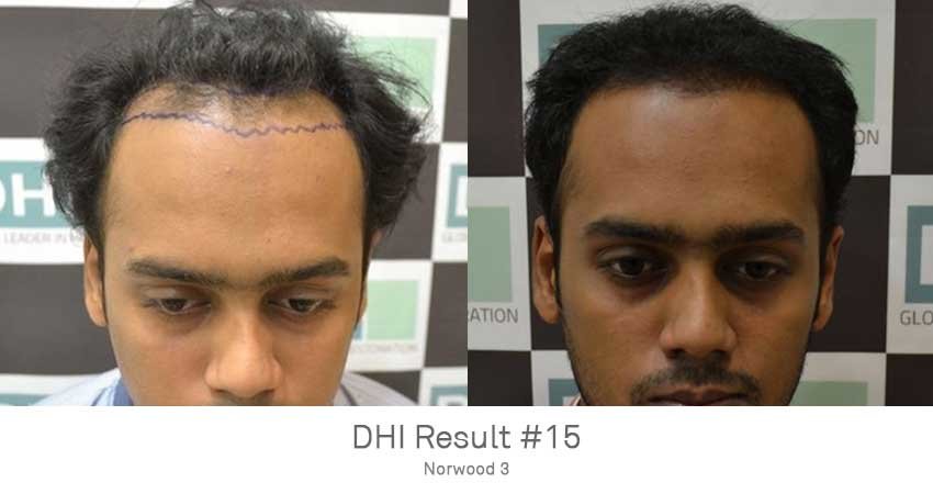 DHI -Hyderabad - DHI -Hyderabad