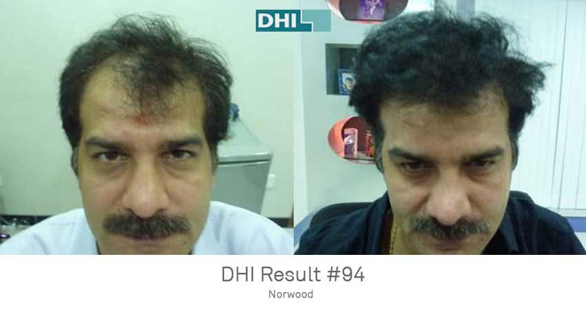 DHI -Hyderabad - DHI -Hyderabad
