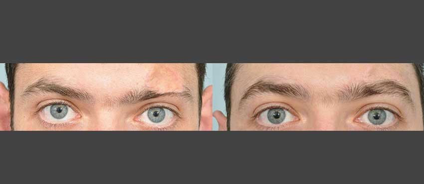 DHI -Hyderabad - DHI -Hyderabad