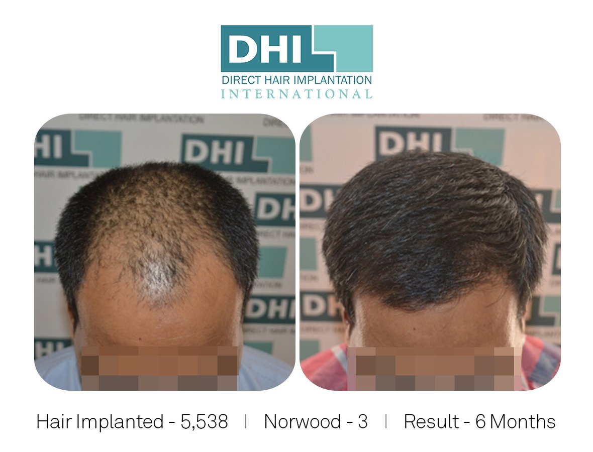 DHI -Hyderabad - DHI -Hyderabad