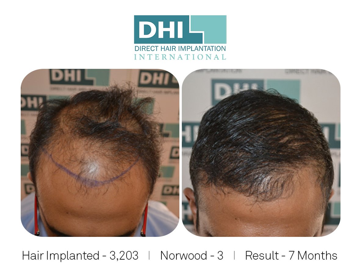 DHI -Hyderabad - DHI -Hyderabad