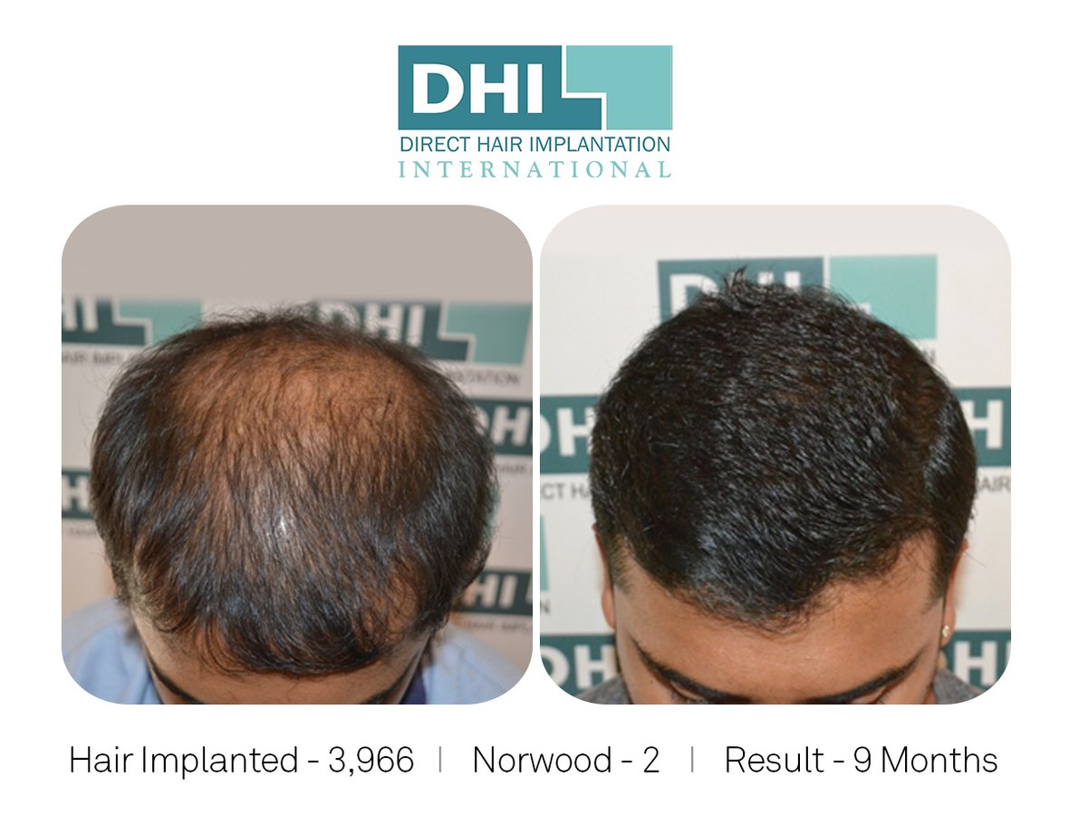 DHI -Hyderabad - DHI -Hyderabad