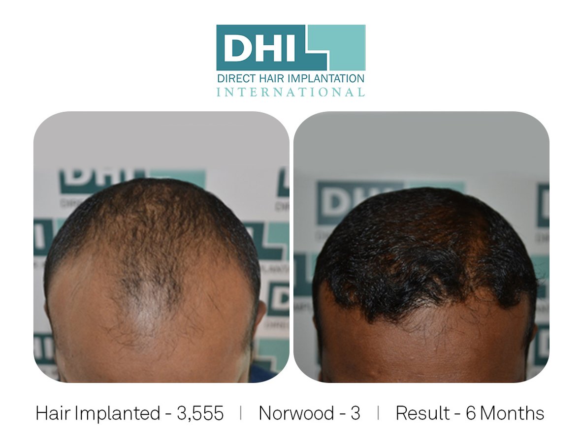 DHI -Hyderabad - DHI -Hyderabad