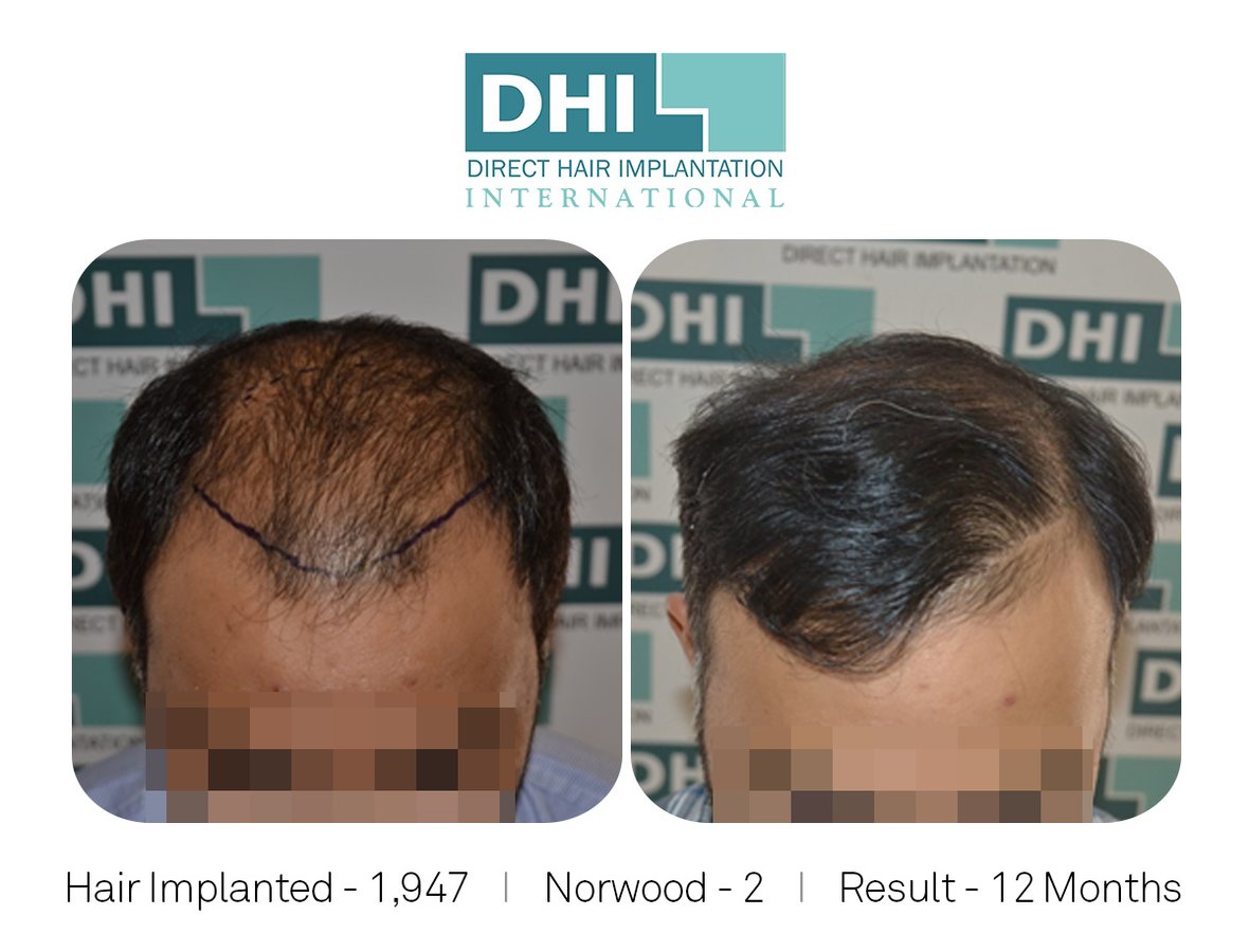 DHI -Hyderabad - DHI -Hyderabad