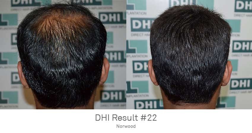 DHI - Jaipur - DHI - Jaipur