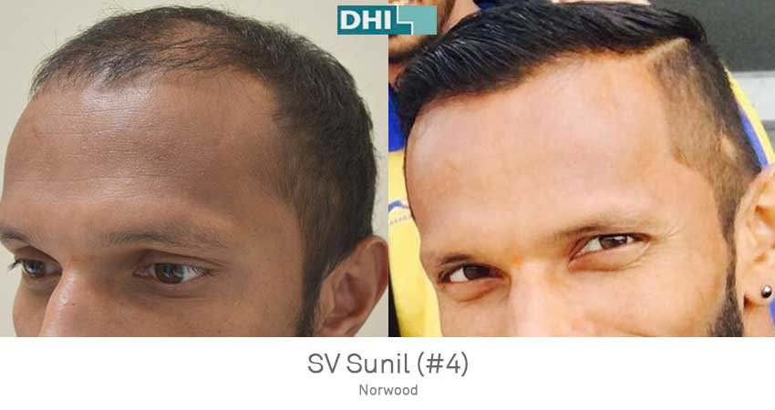 DHI - Jaipur - DHI - Jaipur