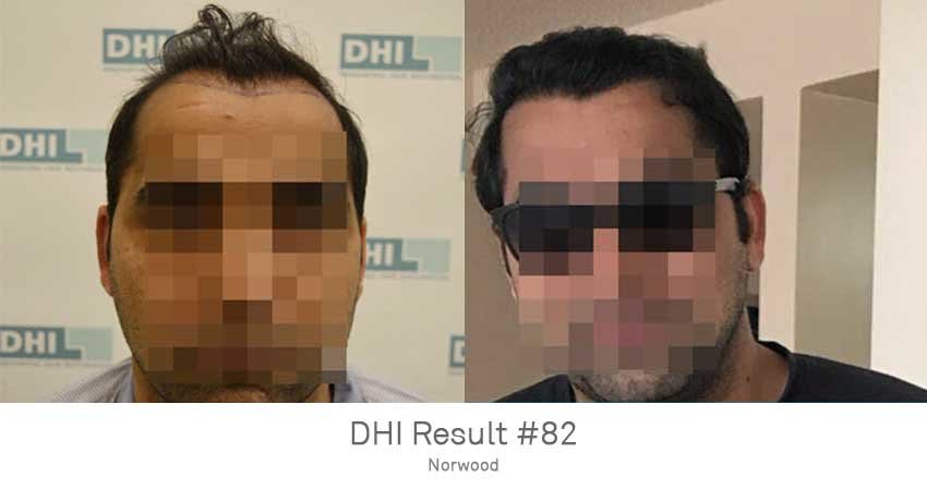 DHI - Jaipur - DHI - Jaipur