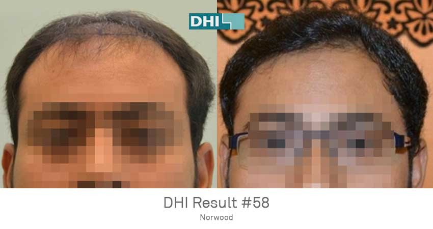 DHI - Jaipur - DHI - Jaipur