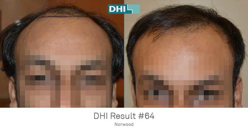 DHI - Jaipur - DHI - Jaipur