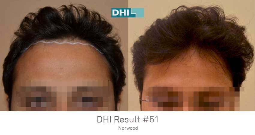 DHI - Jaipur - DHI - Jaipur