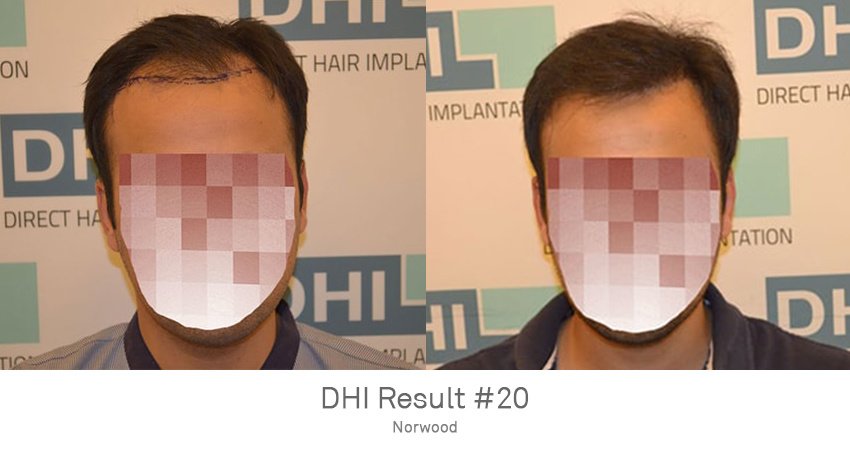 DHI - Jaipur - DHI - Jaipur