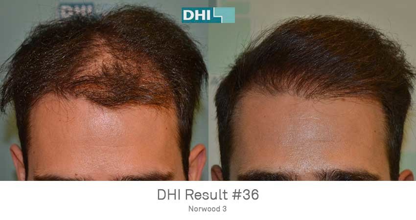 DHI - Jaipur - DHI - Jaipur