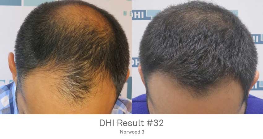 DHI - Jaipur - DHI - Jaipur