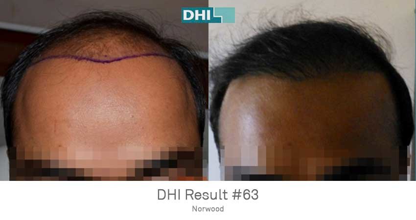 DHI - Jaipur - DHI - Jaipur