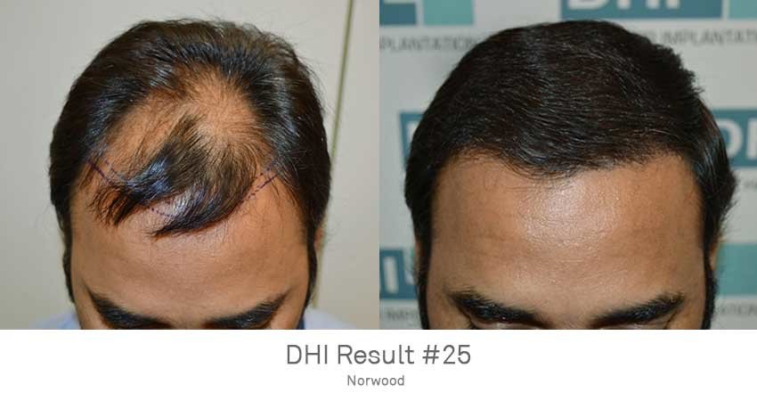 DHI - Jaipur - DHI - Jaipur