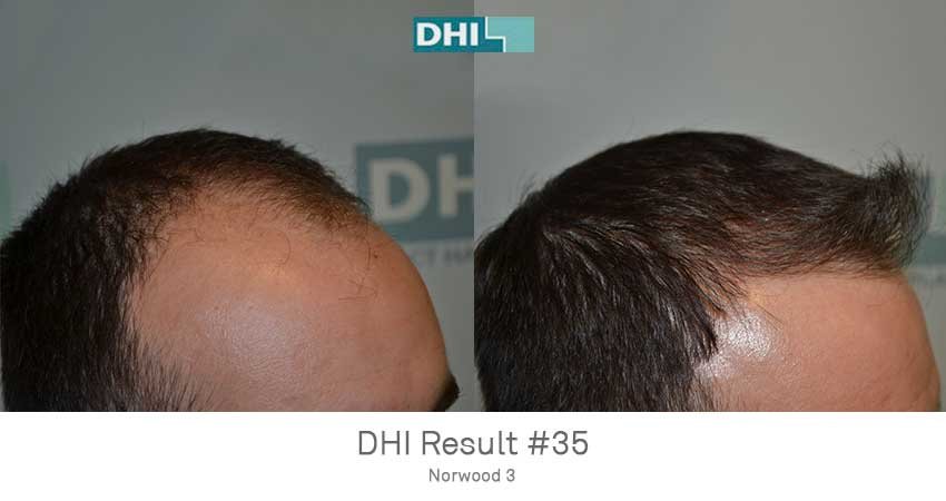 DHI - Jaipur - DHI - Jaipur