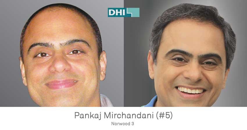 DHI - Jaipur - DHI - Jaipur