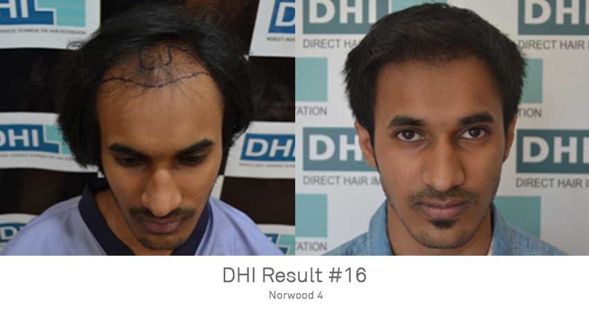DHI - Jaipur - DHI - Jaipur