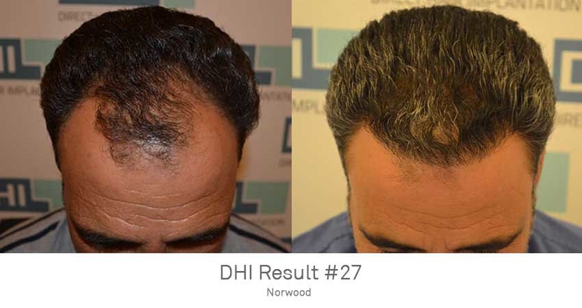 DHI - Jaipur - DHI - Jaipur