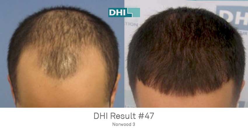 DHI - Jaipur - DHI - Jaipur